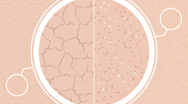 Dry vs Dehydrated Skin: Key Differences